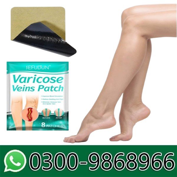 Varicose Vein Tablets In Pakistan
